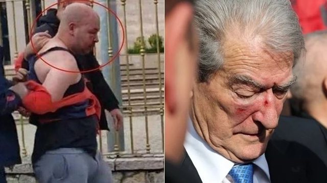 PUBLIKOHEN TË TJERA PAMJE/ Ja çfarë bën agresori pak para sulmit me grusht ndaj ish-kryeministrit Berisha