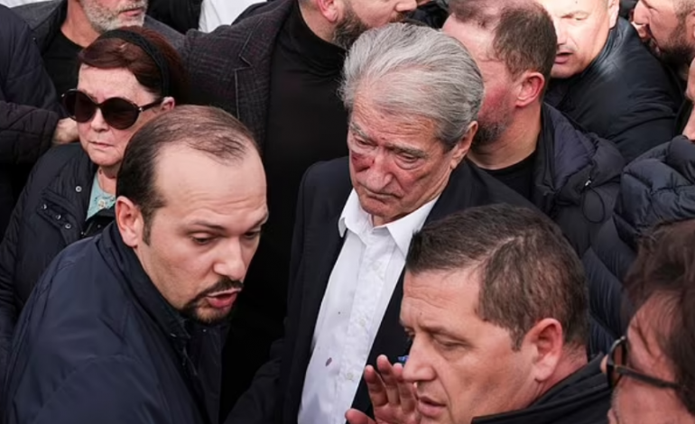 “PATËM FRIKË DHE HEZITIM”/ Drejtori i kabinetit të Berishës tregon çastet pas goditjes së kreut të PD: Ishin momente kur…