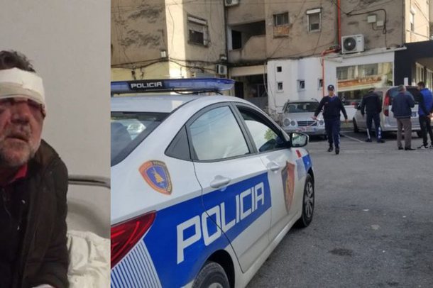 DHUNOI MËSUESIN SE I NGACMOI TË MOTRËN/ Lirohet 29 vjeçari nga Tepelena