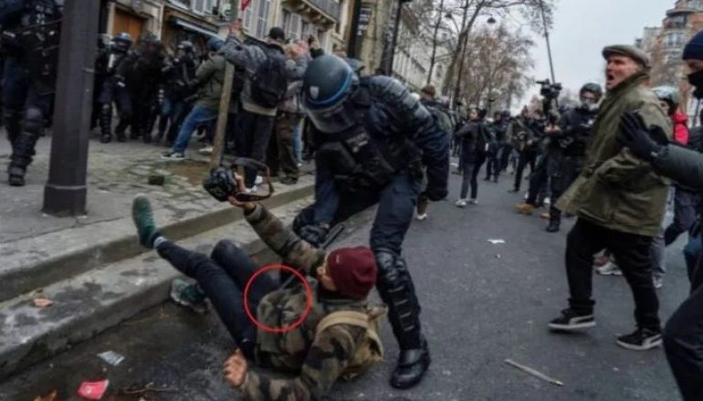 FILMOI PROTESTAT NË FRANCË/ Polici godet 26-vjeçarin me shkop në organin gjenital, mjekët detyrojnë t’i amputojnë…