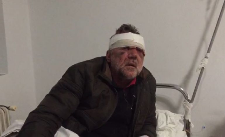 “PROFESOR EJA TË TË QERAS…”/ Mësuesi i masakruar në fytyrë tregon nga spitali dhunën barbare: Më morën me makinë dhe më…