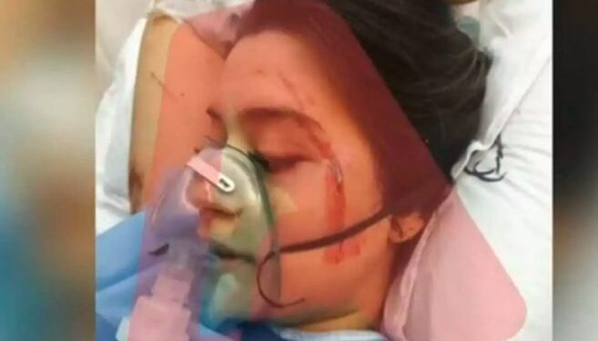 “NJERËZIT PO DIGJESHIN”/ Rrëfimi rrëqethës i 19-vjeçares: Dolëm nga një çarje në dyshemenë e vagonit