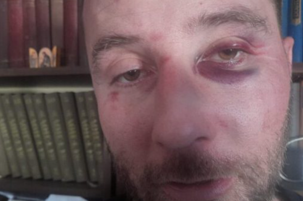 “VUÇIÇ K*RVA”/ Ofendoi presidentin serb, dhunohet brutalisht 37-vjeçari