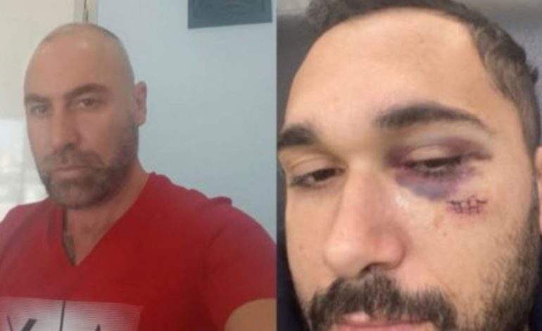“DO TA BËJ TRUPIN…”/ Shkaktoi aksidentin e dyfishtë në Vlorë, shoferi i “Touaregut” ish-drejtori i doganës Fier që kërcënoi burrin e dashnores