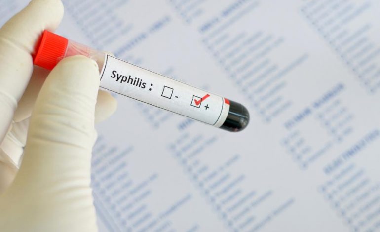 Seksi oral po shpërthen sifilizin në Shqipëri