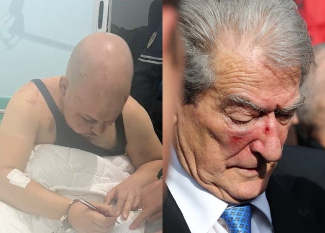 GODITI ME GRUSHT BERISHËN/ Përfundon akti i ekspertimit për Gerti Shehun, zbardhet kërkesa e Prokurorisë