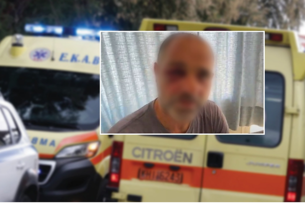 PAMJE TË RËNDA/ Babë e bir me origjinë shqiptare rrahin me bastun grekun në mes të rrugës
