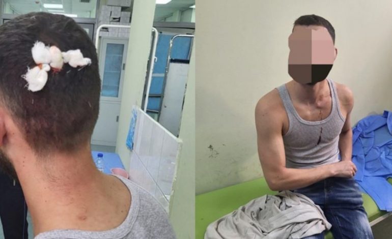 DY SHQIPTARË U GODITËN NË VERI TË MITROVICËS/ Reagon policia e Kosovës: U sulmuan nga grupe kriminale, autorët…