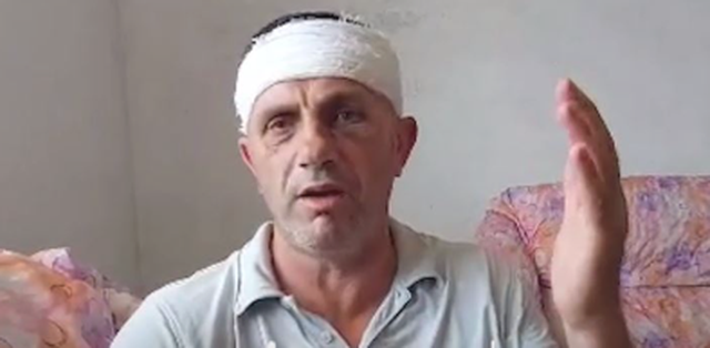 SHERRI PËR GUROREN/ Flet i plagosuri në Borizanë: Më goditën me tyta armësh, i afërmi im është në gjendje shumë të keqe në spital
