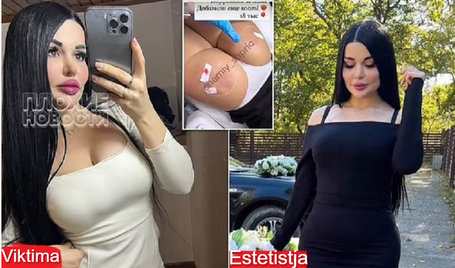 ZMADHOI TË PASMET/ 22 vjeçarja vdes disa minuta pas anestezisë nga estetistja e pakualifikuar