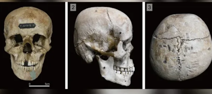 MISTERI I KAFKAVE TË MODIFIKUARA TË NJERIUT NË JAPONINË E LASHTË/ Çfarë thonë studiuesit