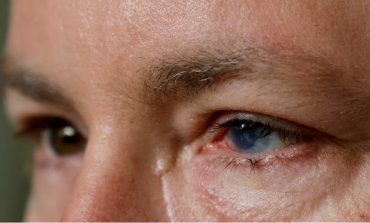 SHPRESË NGA SHKENCA/ Qelizat embrionale të njërit sy mund të shërojnë syrin e dëmtuar