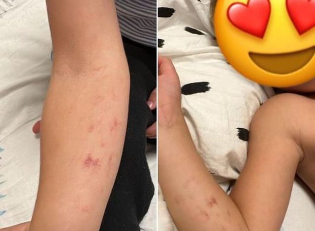 NIPI U RRAH NGA EDUKATORET/ “Ishte i traumatizuar dhe i uritur”, daja: Përveç shenjave të dhunës në trup, ka edhe goditje në kokë