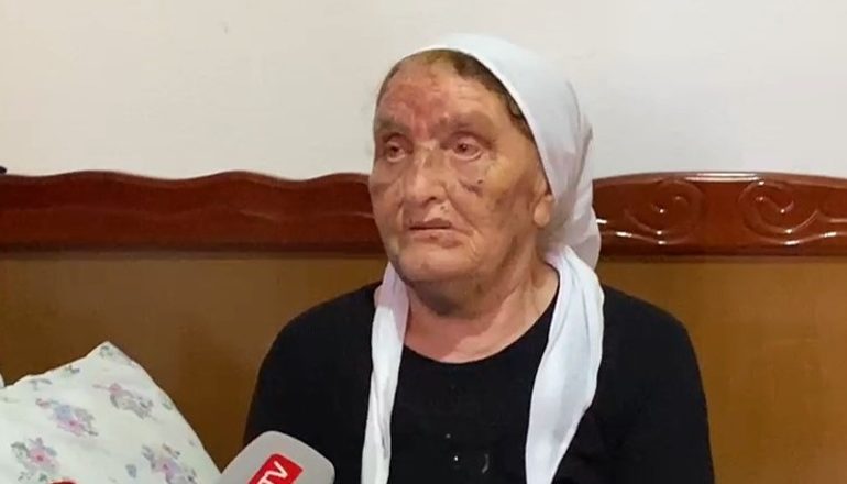 “TORTURË, ISHTE ME KAPUÇ”/ 81 vjeçarja tregon si u dhunua nga hajdutët që hynë t’i vidhnin banesën në Divjakë
