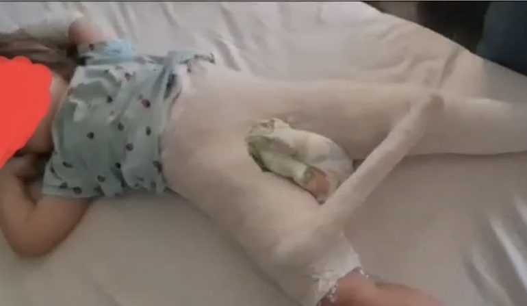 E TRISHTË/ Pas dhunës barbare në kopsht, 3-vjeçarja dëshmi rrëqethëse te Trauma: Më rrahu edukatorja