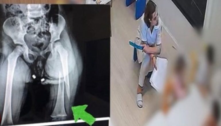 DHUNOI 3-VJEÇAREN/ Edukatorja Majlinda Dehima u kërkon ndjesë familjarëve: S’e kuptova se theu këmbën…