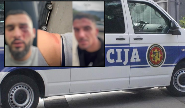 IDENTIFIKOHEN TRE DHUNUESIT E SHQIPTARËVE NË MALIN E ZI/ Policia: Makina e të plagosurve nuk ishte me targa të RSH