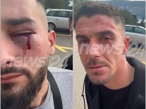 ME PLAGË DHE HEMATOMA/ Ja kush janë të rinjtë e dhunuar në Mal të Zi nga një grup serbësh