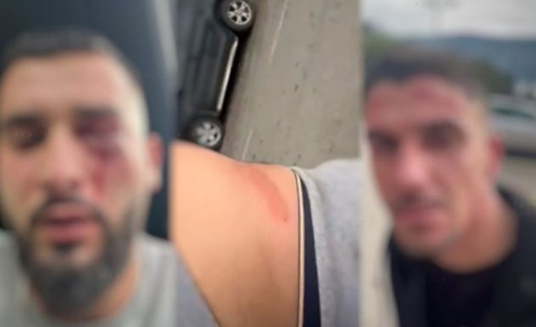 U DHUNUAN NË MALIN E ZI/ Zbulohet dëshmia e të riut: Nuk i provokuam, na goditën në kokë dhe trup