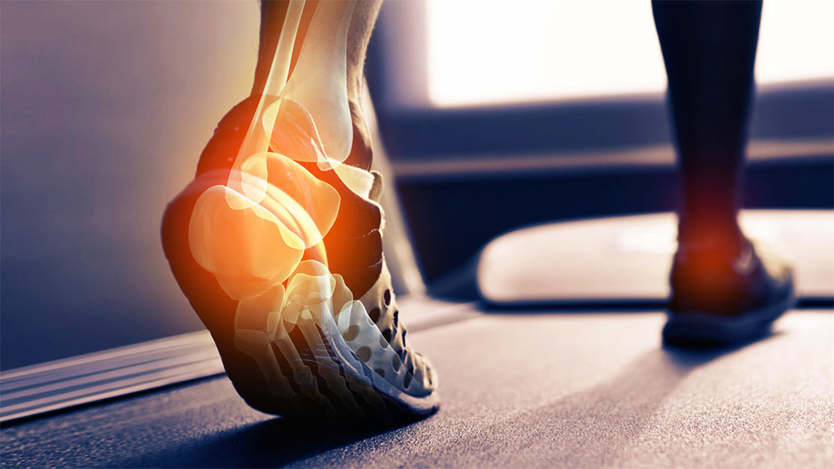 DHIMBJA E KOCKAVE/ Si ndikon një orë ecje në javë për osteoartritin