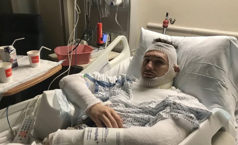 PAMJET/ Shqiptari hero, mbrojti të fejuarën kur një maniak e sulmoi me lëndë djegëse