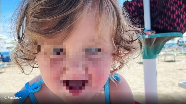 E RËNDË/ Vogëlushja 18 muajshe humbi jetën pasi gëlltiti një tapë, reagimi i nënës: Mjekët humbën shumë kohë