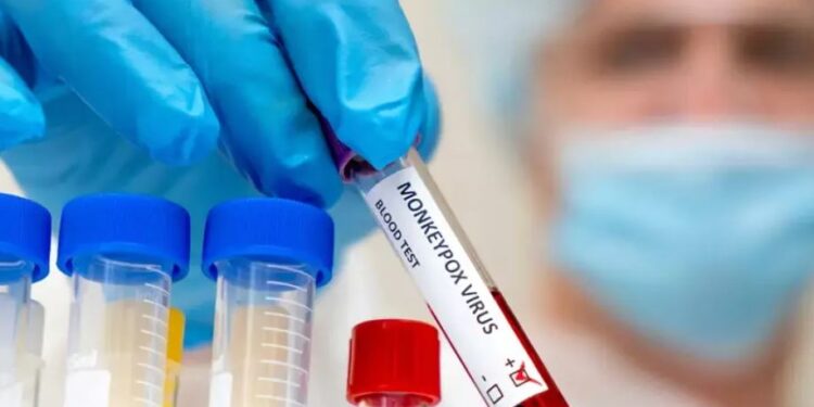 OBSH E SHPALLI EMERGJENCË GLOBALE/ Çfarë dihet për linë e majmunëve dhe sa është rreziku i vdekshmërisë
