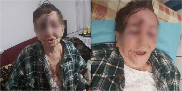 NUSJA RREH BARBARISHT VJEHRRËN NË SHKODËR/ Djali e mban të mbyllur në shtëpi! Arrestohet 43 vjeçarja