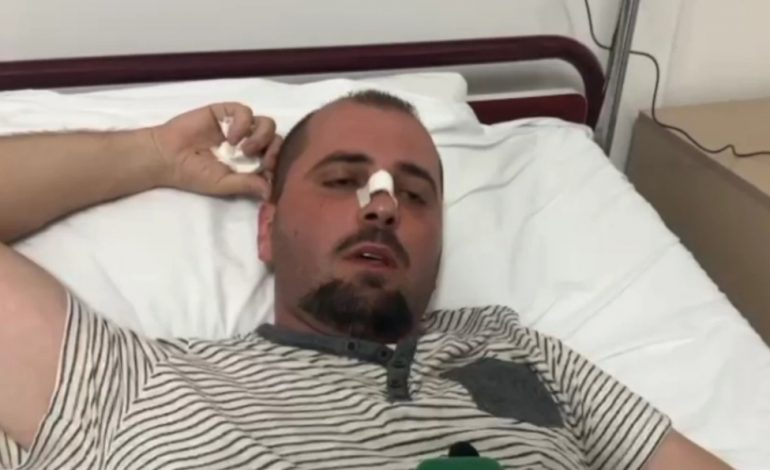 “MË THIRRI O GANGSTER”/ Polici bashkiak rrëfen dhunën barbare: Mori levën dhe…