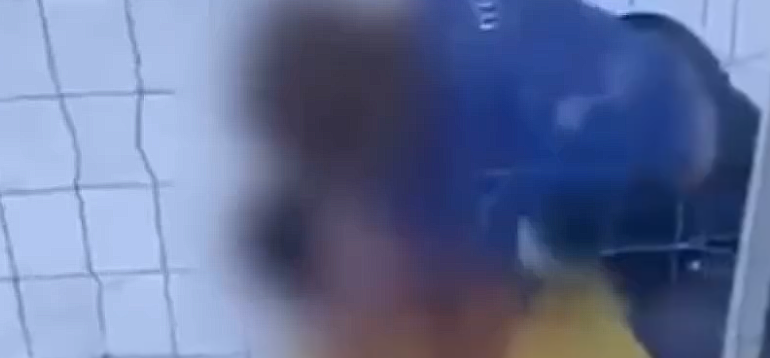 PAMJET E RËNDA/ Dhunohet barbarisht 12-vjeçari në Greqi, në pranga adoleshenti shqiptar dhe i ati