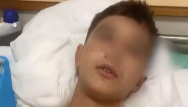 VRASJA E MARTIN CANIT/ Shoku i tij Luisi mbeti i plagosur, niset për kurim në Bari të Italisë