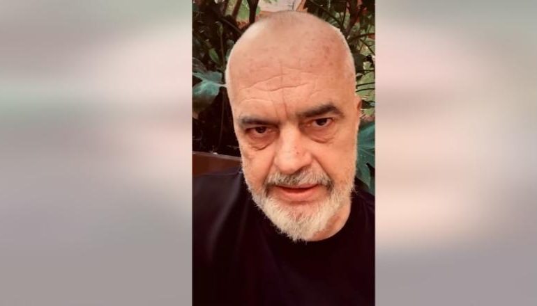 HEDH POSHTË AKUZAT E BERISHËS PËR AGAÇIN/ Rama: E ‘shpalli në kërkim’, shpifje nga këneta! Në Itali iu nënshtrua operacionit