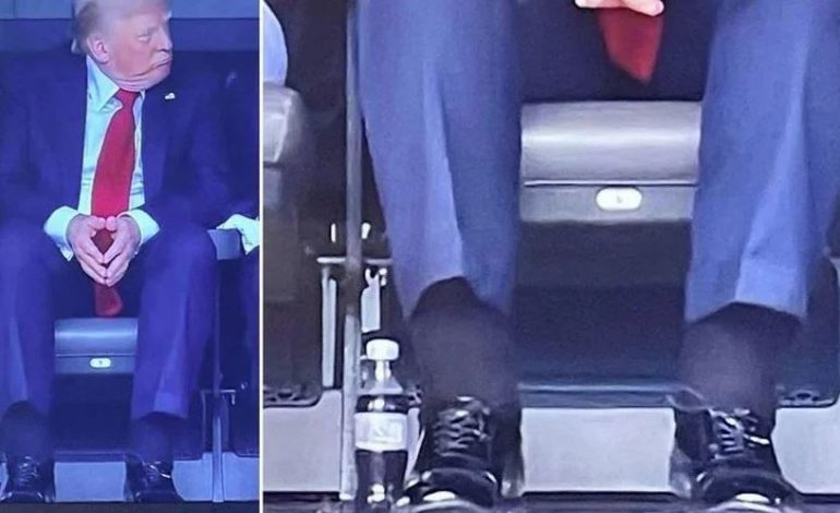 FOTOT VIRALE TË PRESIDENTIT TË SHBA/ Shtëpia e Bardhë: Trump vuan nga pamjaftueshmëria venoze kronike