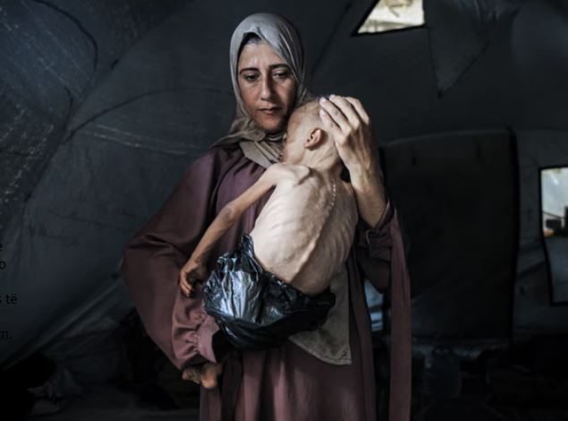 KATASTROFAT HUMANITARE/ Qindra të vdekur nga kequshqyerja në Gaza, shumica prej tyre fëmijë