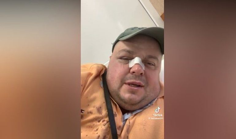 “PSE BËNI ZHURMË NË LOKAL?” Zbulohet arsyeja pse u dhunua, Genard Hajdini dhe babai i tij