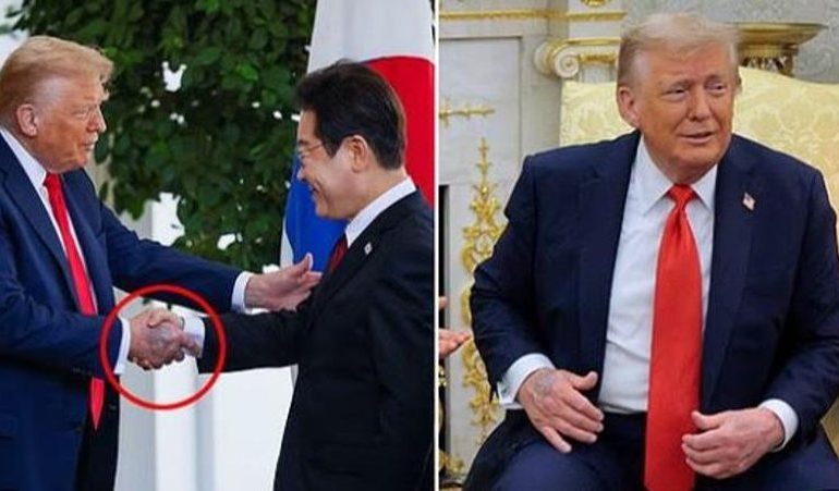 DORA E DONALD TRUMP E MAVIJOSUR/ Presidenti amerikan sërish në qendër të vëmendjes në lidhje me shëndetin e tij