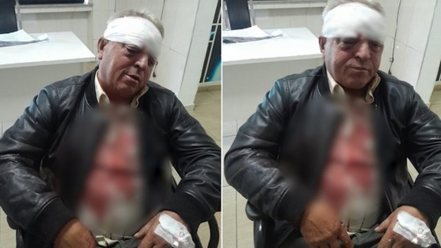 “TA TREGOJMË NE…”/ Dy të rinj e bënë për spital, FLET i moshuari nga Vlora: Kam 3 fraktura në kokë, 100 veta ishin aty…