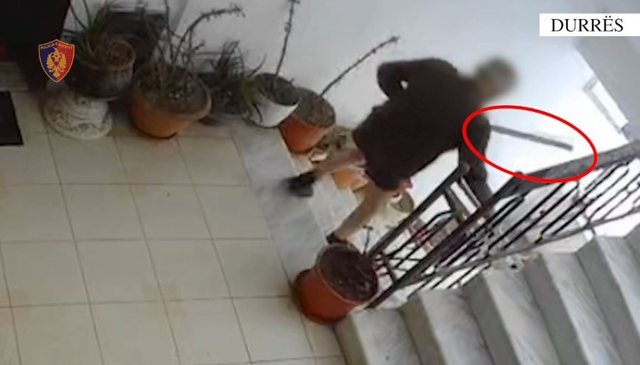 SHOKUESE NË DURRËS/ Burri tenton të vrasë gruan, e goditi me sende të forta në kokë