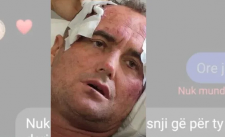 “JE MË E BUKURA E FSHATIT”/ Reagon motra e 46-vjeçarit të dhunuar pas publikimit të mesazheve: Mjaft me këtë telenovel