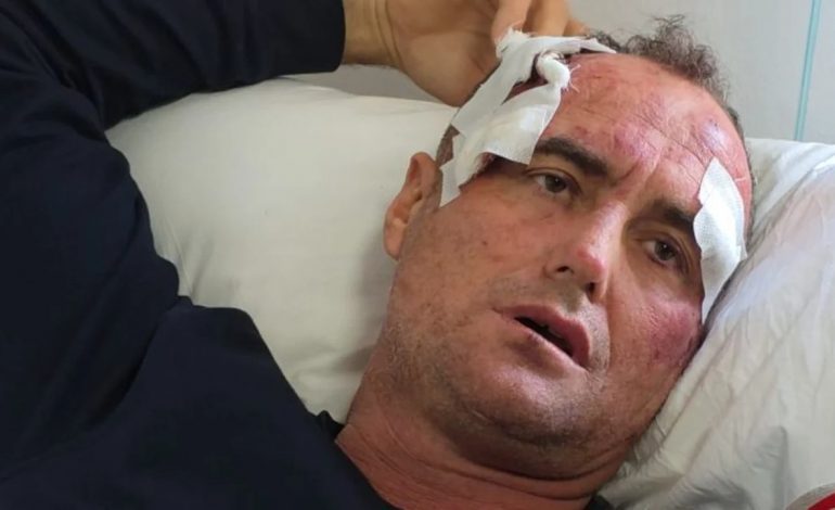E RËNDË NË FIER/ I bëra motrës së tij një koment në Facebook”, punonjësi i policisë dhunon babë e bir