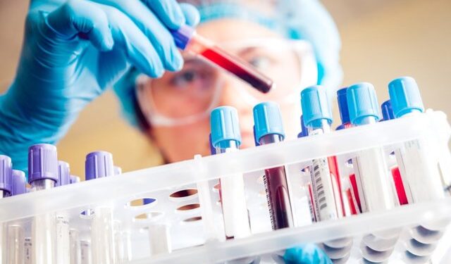E RËNDË/ 47-vjeçarja shqiptare në Itali humb jetën pas diagnozës së gabuar, familja dëmshpërblehet me 300 mijë euro