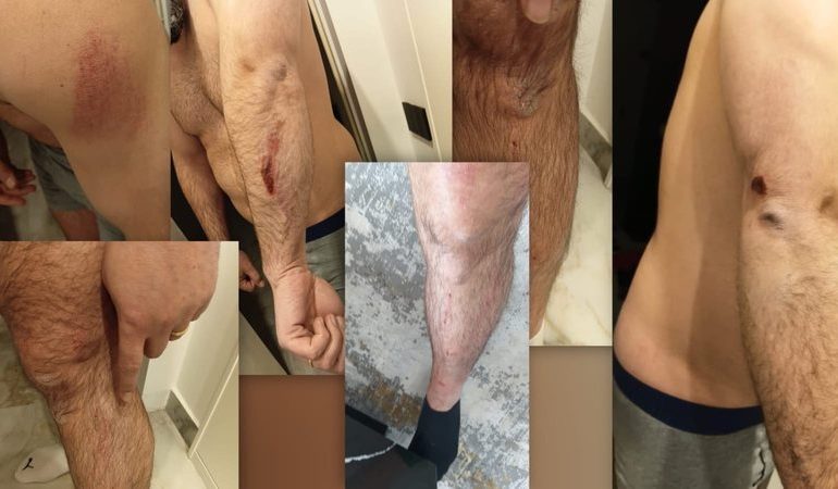 PUBLIKOHEN PAMJET E DHUNËS/ Protestuesit e Rrjollit rrahin brutalisht në studion e Fevziut djalin e trashëgimtarit të tokës
