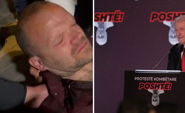 AULON KALAJA I PLAGOSUR GJATË PROTESTËS/ Berisha: Narko-policia e goditi me urdhër të Edi Ramës