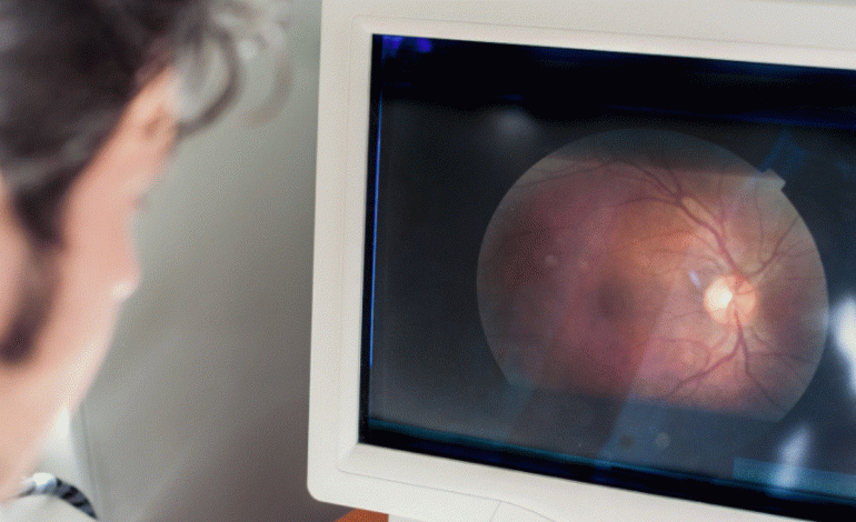 SYTË MUND TË ZBULOJNË RREZIKUN E ALZHEIMER/ Studimi: Retina si “pasqyrë” e shëndetit të trurit