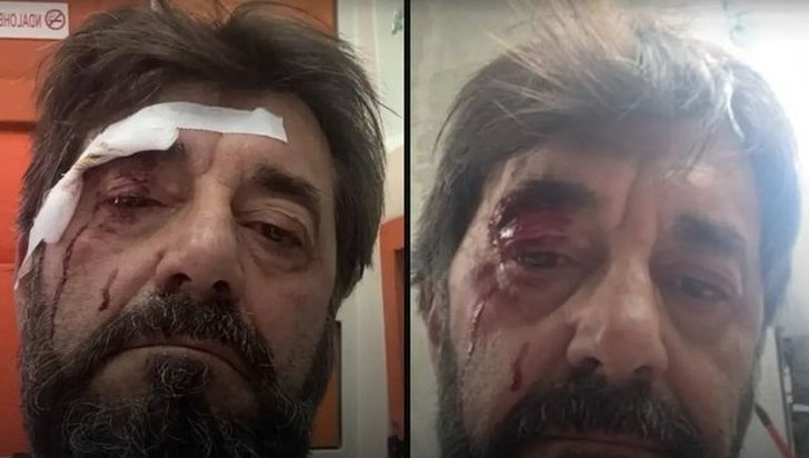 FOTOLAJM/ Dhunuan gazetarin Ilir Demalia, dalin pamjet e agresorëve