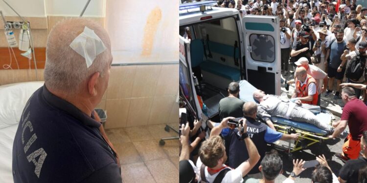 DHUNA PARA PARLAMENTIT/ 11 protestues dhe 6 efektivë paraqiten në QSUT dhe te Trauma, ja gjendja e tyre