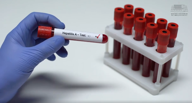 DITA BOTËRORE E HEPATITEVE/ MSH: Miratohet për herë të parë Plani Kombëtar për Eliminimin e Hepatiteve Virale