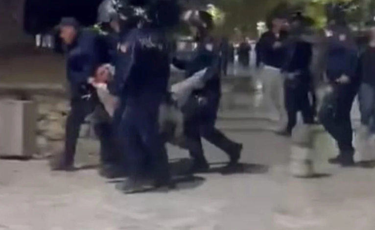 IU THYE KËMBA GJATË PROTESTËS/ 19-vjeçari i nënshtrohet ndërhyrjes kirurgjikale