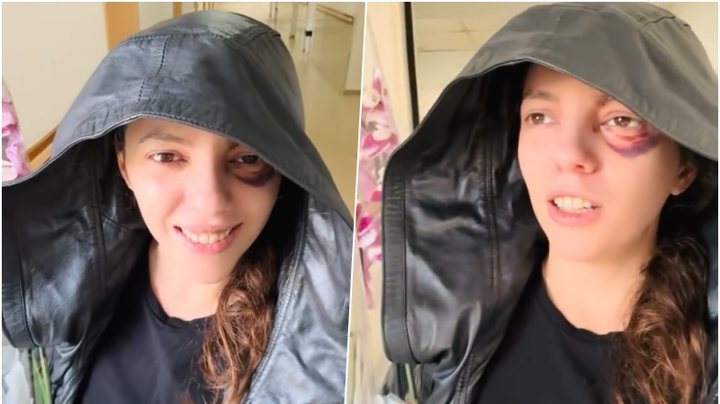U PLAGOS NË SY GJATË PROTESTËS/ Eva Pango del nga Spitali i Traumës: Më e motivuar se kurrë…