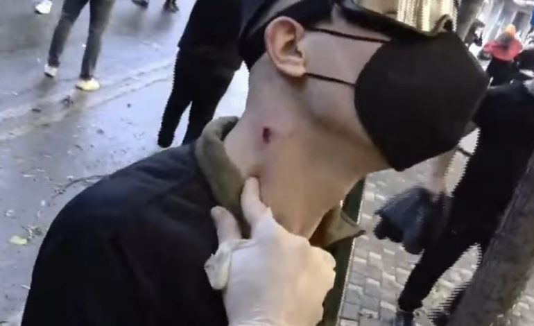 PAMJE TË RËNDA/ Policia qëlloi me plumba gome, i riu me plagë në qafë